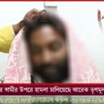 দীর্ঘদিন ধরে কঙ্কালসার রাস্তা দেখে ক্ষিপ্ত এলাকাবাসীরা